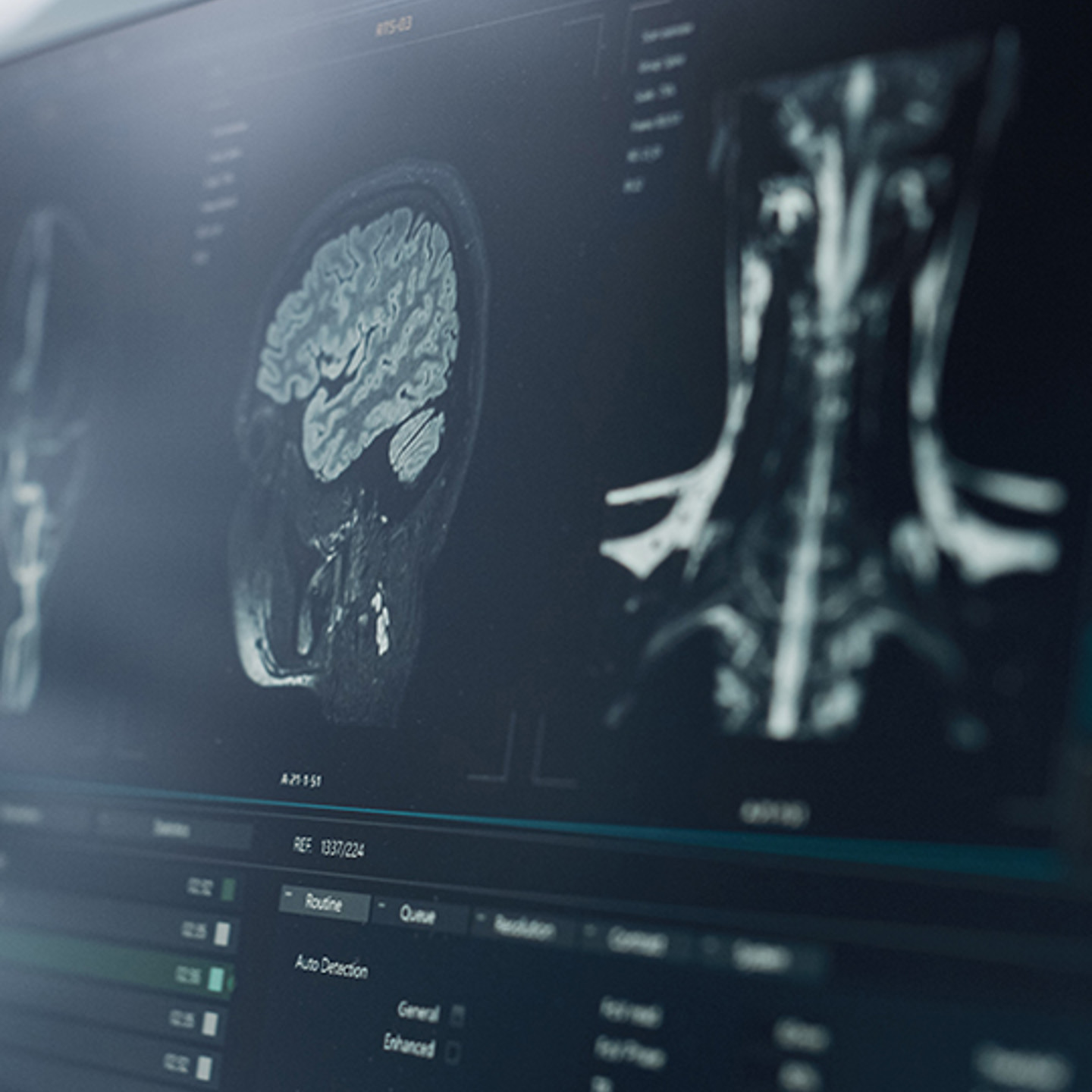 Medavis Portrait 1 scans of the human body